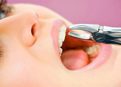 مراقبت های بعد از کشیدن دندان؛ نکات ضروری و کابردی